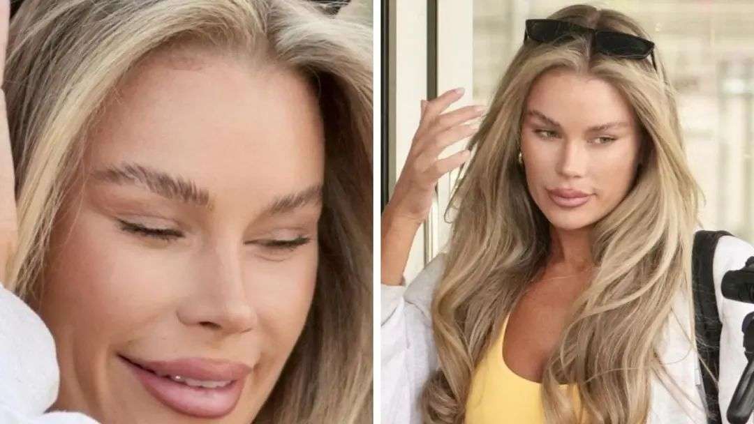 First pics of Skye Wheatley without bandages after fox eye surgery –  Gallery | news.com.au — Australia's leading news site
