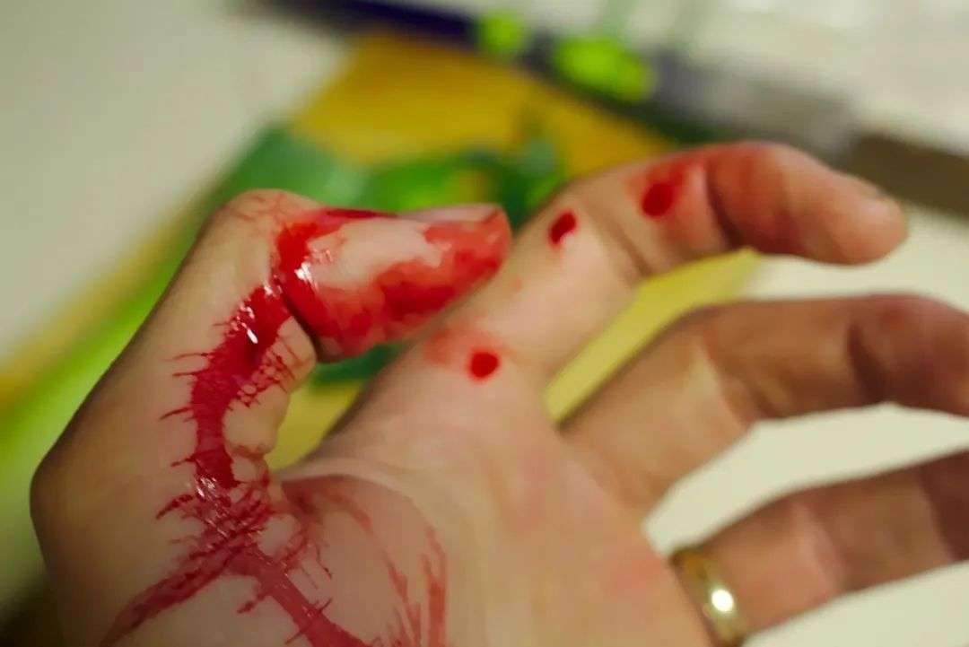 Free Accident Bleed photo and picture