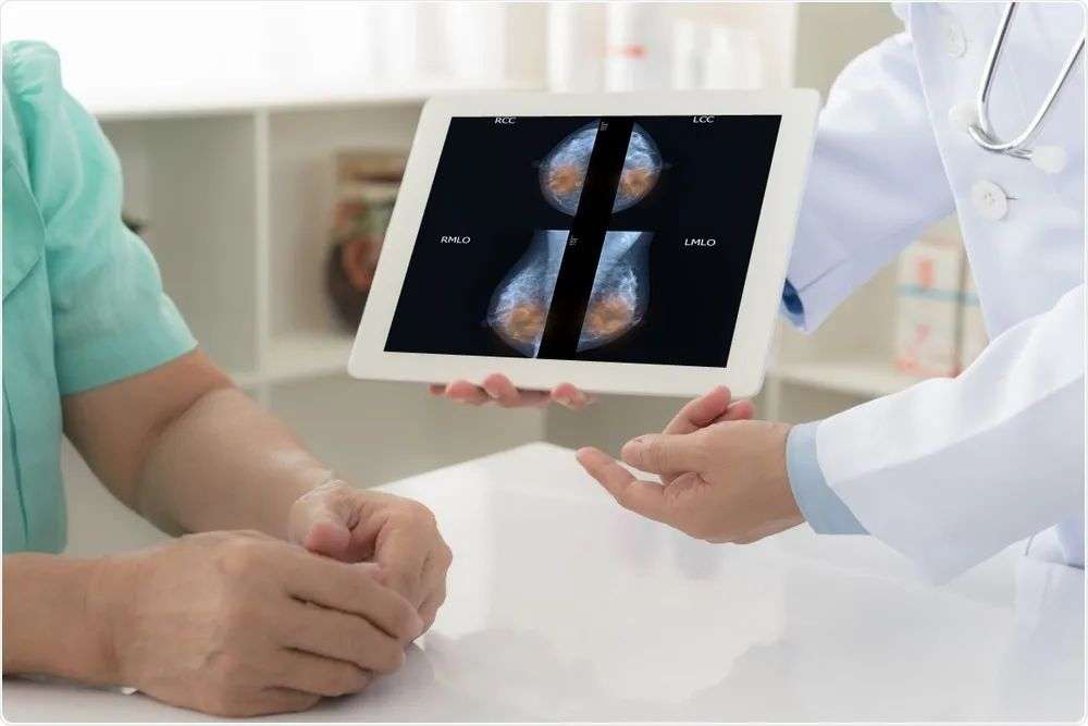 AI can predict breast cancer risk up to 5 years before diagnosis