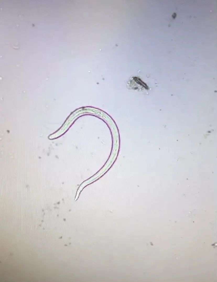 A gif showing a rat lungworm at its larvae stage.