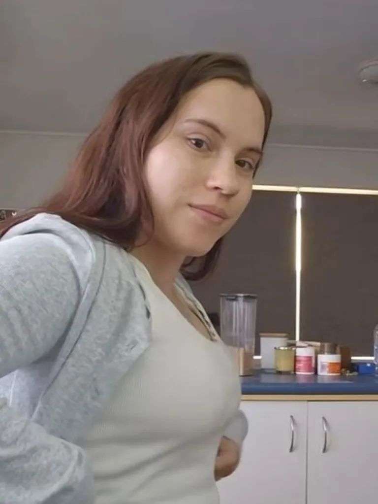 After her surgery. Picture: TikTok/@amyhills6