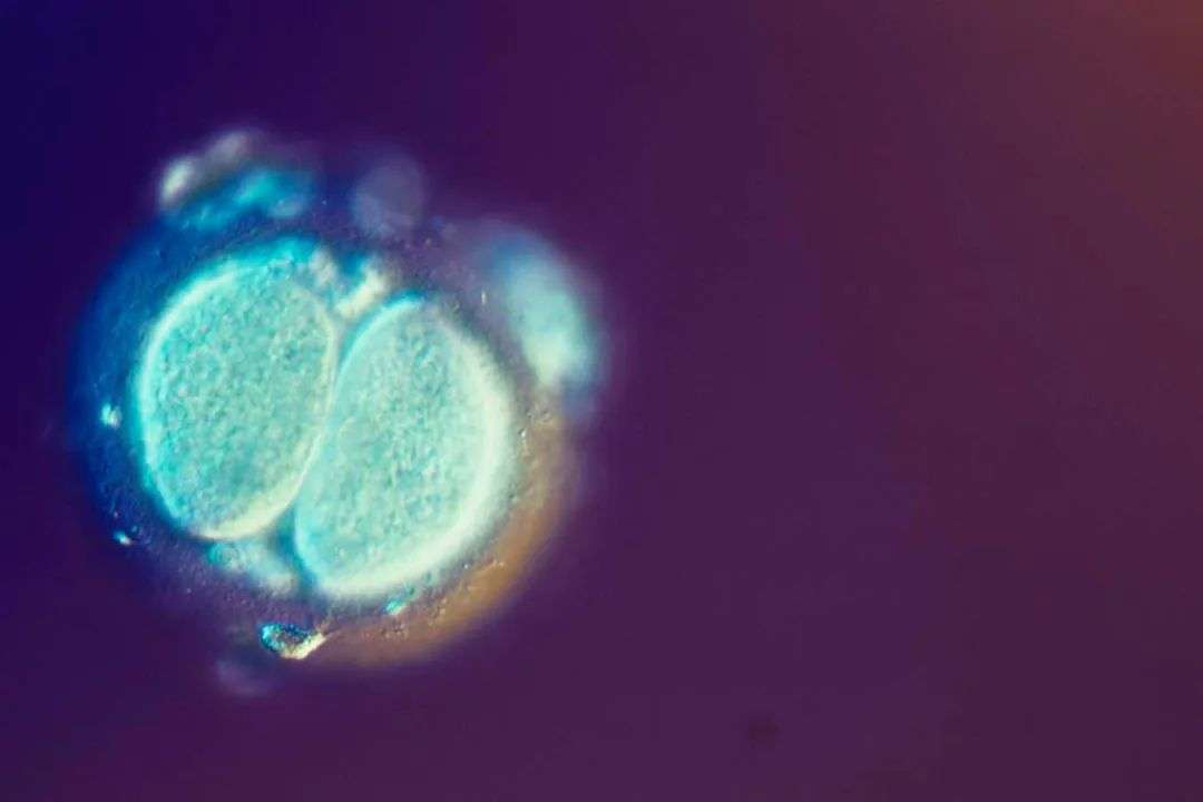 Fertilised human egg cell dividing. Polygenic DNA tests can be used to show the disease risk score of embryos