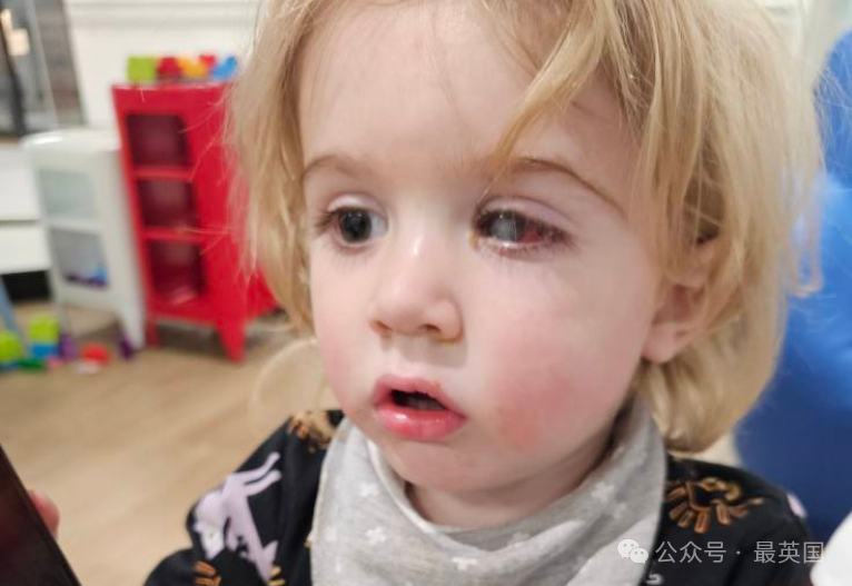 Don't Let Anyone Kiss Your Baby, It's Not Worth It' - Mouths of Mums