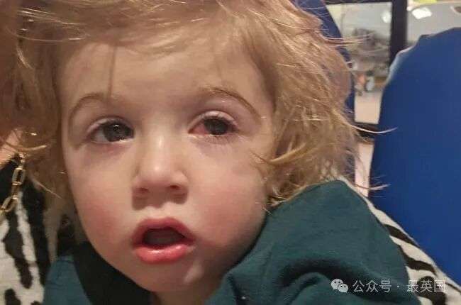 Herpes shock: parents believe their baby lost sight in one eye because of a stranger's kiss | You