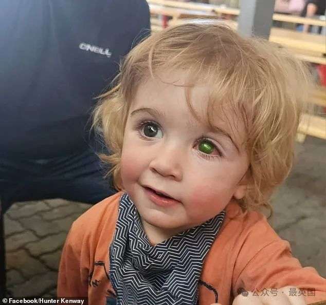 Two-year-old Juwan lost sight in his left eye after a simple kiss transferred the cold sore virus to the eyeball
