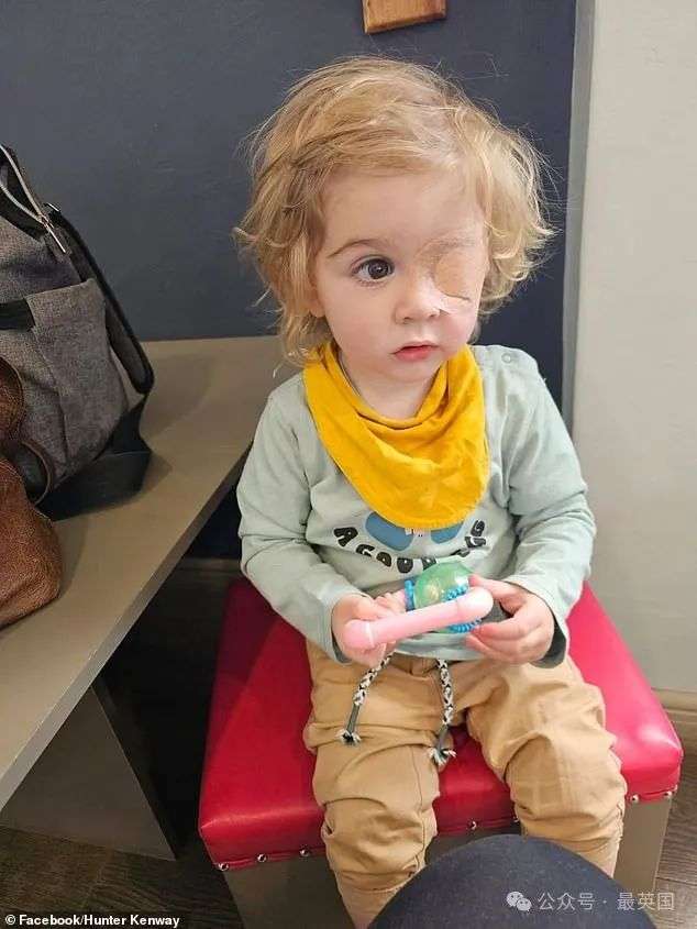 Doctors were eventually forced to sew his eyelids shut in a bid to protect what remained of the organ