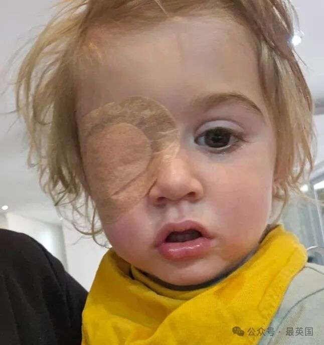 Toddler may lose his eye after being kissed by someone with herpes virus | News World | Metro News