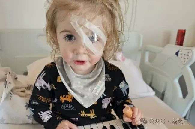 Herpes shock: parents believe their baby lost sight in one eye because of a stranger's kiss | You