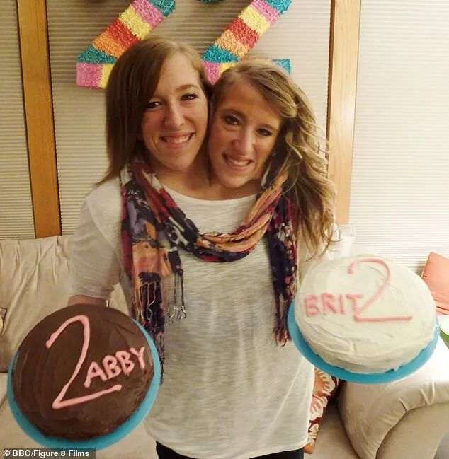 Abby and Brittany are pictured holding their separate birthday cakes when they celebrated their 22nd birthday