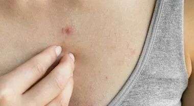 Marissa trovata morta nel letto a 28 anni, la mamma: «È sopravvissuta al cancro ma