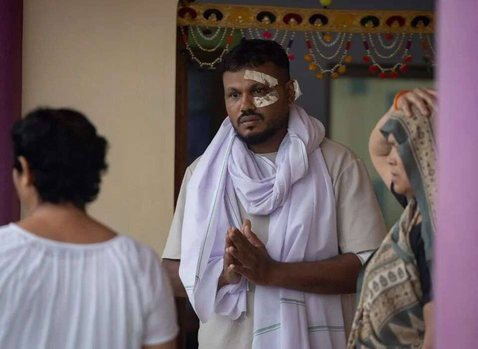 印度航空空难的唯一幸存者，眼睛上缠着绷带。