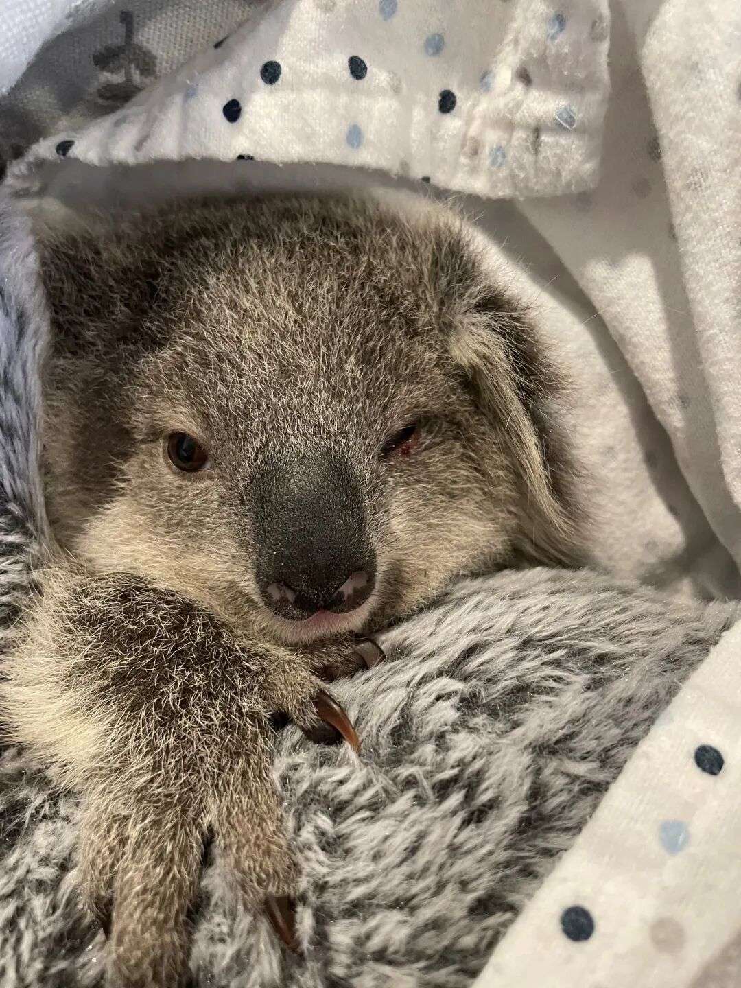 a koala called gage with an eye injury after being hit by a car is swaddled in a rug