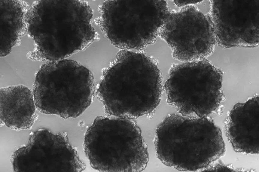 A magnified image of some blobs with bumpy edges