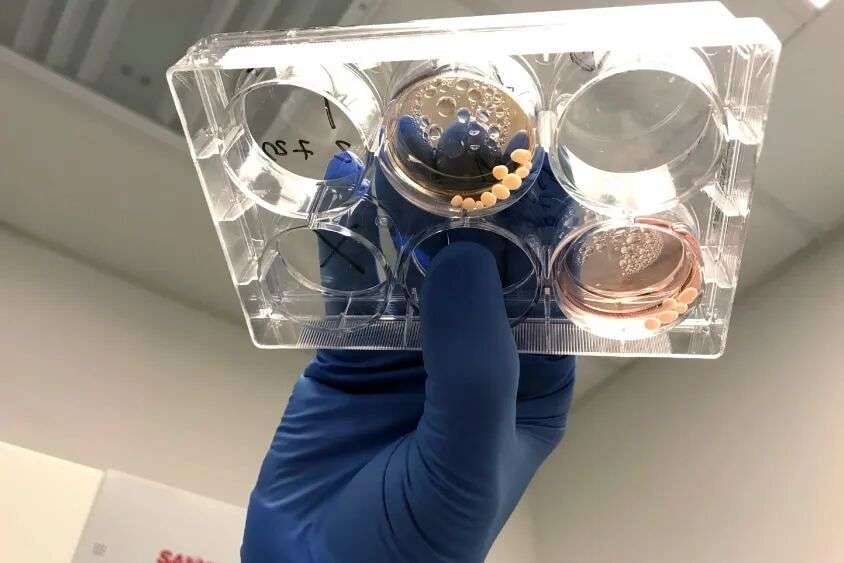 A gloved hand holds up a dish with lab grown brain tissue