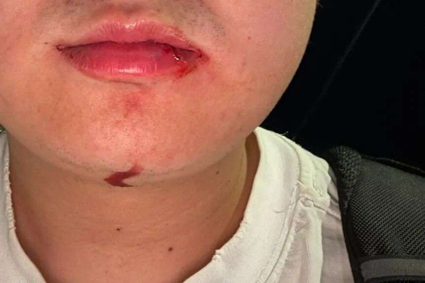 一名身穿白衣的男子嘴角和下巴都在流血。