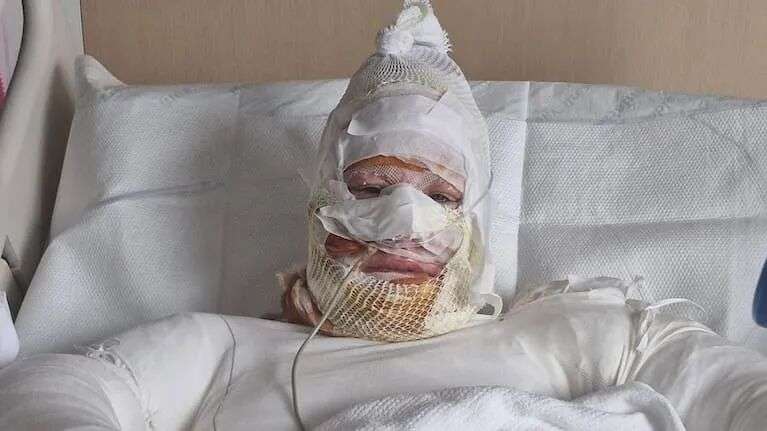 Penny Travers, a Perth-based disability support worker, spent 17 days in hospital after a firebomb was hurled at her vehicle in the early hours of October 6.