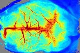 激光散斑血流成像系统,激光多普勒血流成像仪,脑血流仪厂家-瑞沃德