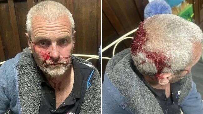 Rodney was knocked to the ground by the intruders and left unconscious and bleeding.