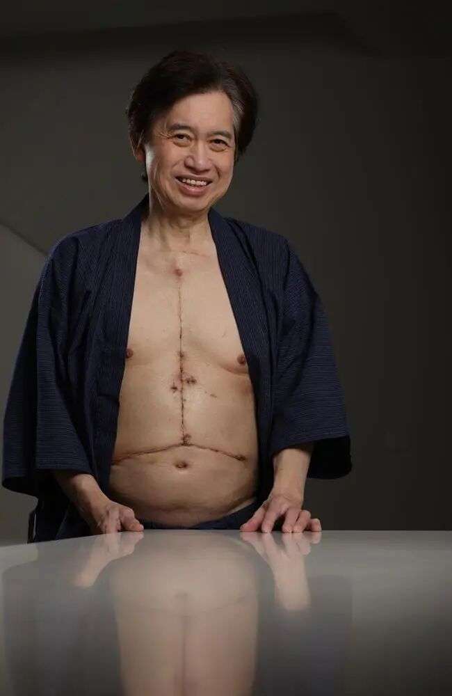 Hock Yap, 68, is home with his family and says his life has been profoundly changed following his near-death experience. Picture: David Caird