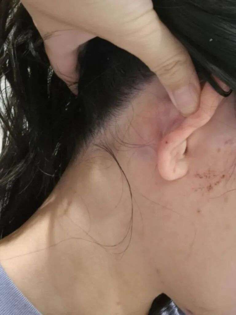 The 27-year-old was left ‘terrified’ and hospitalised. Picture: 7News.com.au