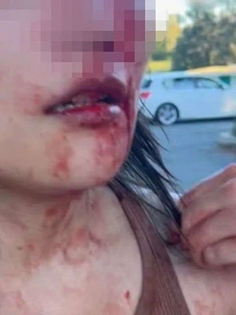 The woman was on a walk with a friend before her face was covered in blood. Picture: 7News.com.au