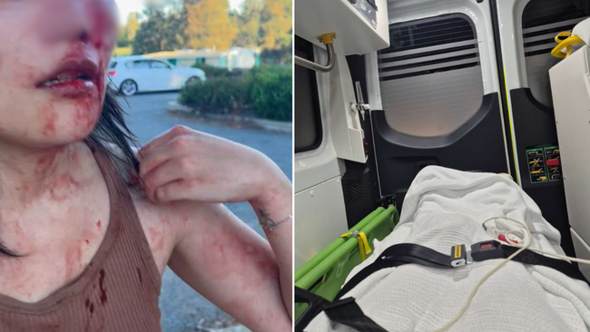 KK Zhang was left bloodied after she was allegedly racially abused in Canberra.